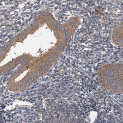 N4BP2L2 Antibody, Novus Biologicals 0.1mL; Unlabeled:Antibodies, Polyclonal